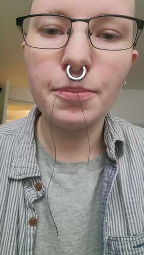 Erynrose – 26 02 2023 2775955109 – A Visit To The Dental Hygienist Got Me 2 1920p - Cover