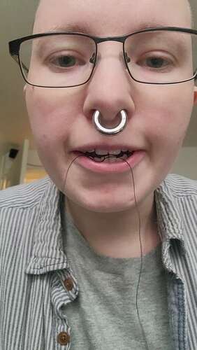 Erynrose – 26 02 2023 2775955105 – A Visit To The Dental Hygienist Got Me 1 1920p - Cover